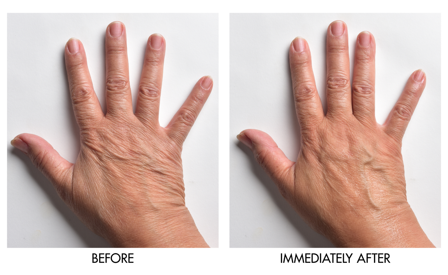 Instant Hand Perfector